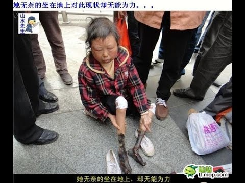 【衝撃】中国の路上でミイラ化した足の女性が助けを求めている！