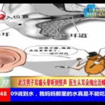 【閲覧注意】人間の耳の中でゴキブリが繁殖！【中国】